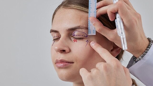 Sarkan Göz Kapakları: Estetik Bir İhtiyaç mı,   Yoksa Ciddi Bir Görme Sorunu mu?